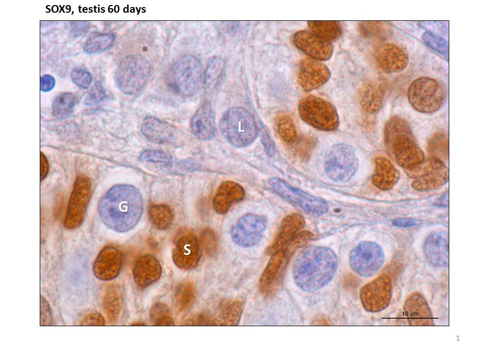New ReproUnion paper published in Nature Scientific Reports